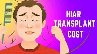 Cost of Hair Transplant in India  What is Average & Minimum Cost of Hair Transplant in India