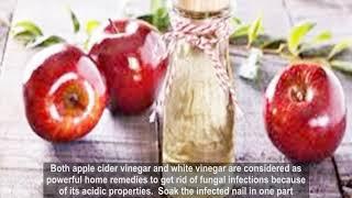 From tea tree oil to apple cider vinegar 7 home remedies to treat toe nail fungus