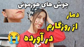 جو‌ش های هورمونی و درمان جوش صورت -  مشکلات هورمونی باعث چه چیزی میشود ؟