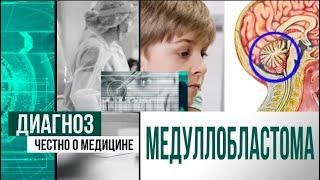 Медуллобластома чем опасна опухоль головного мозга?  Диагноз