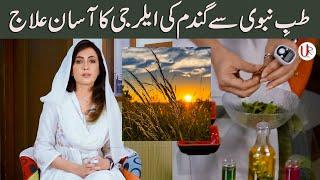 Tib e NAbvi se Wheat Allergy ka Ilaaj   Dr. Umme Raheel