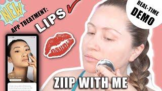 ZIIP HALO LIP PLUMPING TREATMENT  w before & After