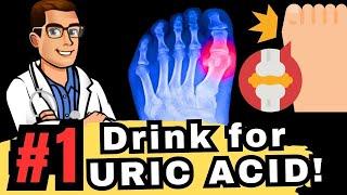 TOP 5 Drinks to Reverse High URIC ACID & GOUT