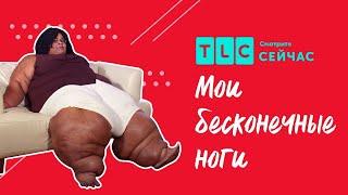 Вдохновляющий пример  Мои бесконечные ноги  TLC