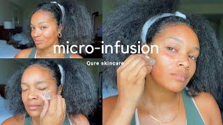 Qure skincare Micro-Infusion  Microneedling at Home