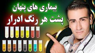 هر رنگ ادرار نشانه چه بیماری هایی است؟  What Diseases Does Each Color of Urine Indicate?