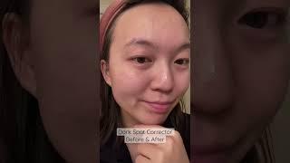 Do dark spot correctors work? Before vs. After - 20s Skincare #shorts #kiehls