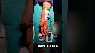 TRAIN OF FOUR NEUROMUSCULAR MONITORING