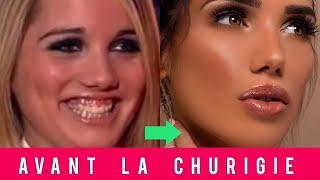 Les stars de télé-réalité avant la chirurgie esthétique  Manon  Nabilla Maeva Ghennam Paga