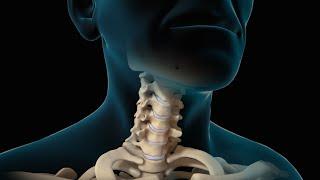 Neck Surgery  Cervical Discectomy  Nucleus Health