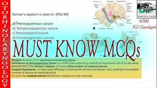 MCQs  Ear  ENT  Visual Explanation Mnemonics  AIIMS PGI JIPMER  DIP Medical Video  Part 2