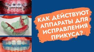 Кривые зубы. За счет чего можно исправить их положение?