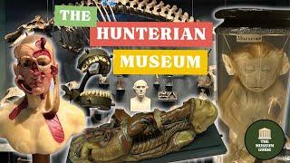 Londons Grisliest Museum? A Guided Tour of The Hunterian Surgical Museum