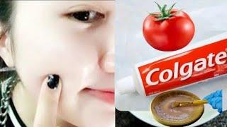 Mix tomato and toothpaste  A mask to whiten the skin and look younger