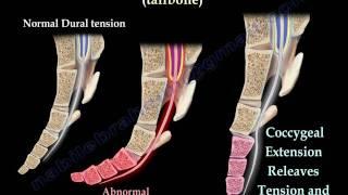 Coccyx Tailbone pain coccydynia - Everything You Need To Know - Dr. Nabil Ebraheim