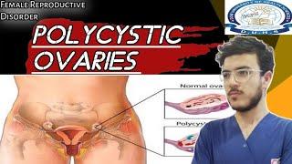 Polycystic Ovaries  AHN  Female Reproductive Disorder  Dow