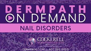 Nail Disorders