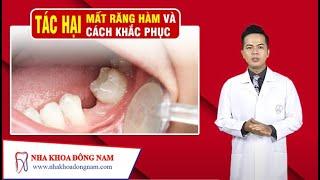 Tác Hại Của Việc Mất Răng Hàm Và Cách Khắc Phục  NHA KHOA ĐÔNG NAM®