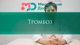 Тромбоз подкожных вен. Тромбофлебит