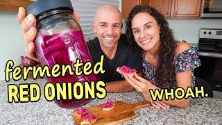 VIRAL RECIPE TEST Quick Pickled vs. Fermented Red Onions 3 Recipes