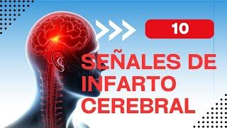 10 signs you will have a stroke