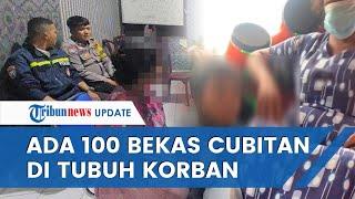 FAKTA Kasus Nenek di Padang Aniaya Cucu di Angkot Korban Dipaksa Ngemis & Punya 100 Bekas Cubitan