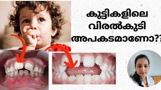 #thumbsucking കുട്ടികളിലെ വിരൽകുടി അപകടമാണോ??Dr. Anagha Cheleri