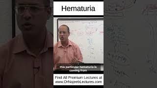 Hematuria #shortvideo #shorts #drnajeeb #drnajeeblectures