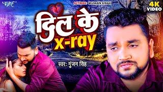 2024दर्द भरी गजल#दिल के X Ray #gajal_song_hindi#बेबफाई#जख्मी_दिल#Gunjan Singh #गजल#2024