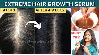 My Mom turned her Thin Hair to Thick Hair in 30 days -Result in 1st Use Extreme Hair Growth Serum