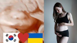 임신 후기 part 1 한국에서 임신에 대한 놀란 점. 우크라이나와 차이. Третій триместр вагітності в Кореї що здивувало