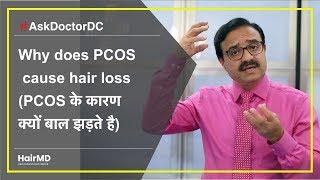 Why does PCOS cause hair loss PCOS के कारण क्यों बाल झड़ते है  HairMD Pune  In HINDI
