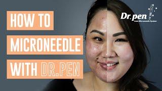 How to microneedle at home with Dr. Pen  Dr. Pen Australia  Microneedling  Skin Needling  CIT