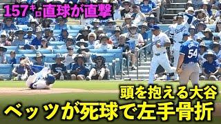 ベッツが死球で左手骨折のアクシデントに大谷翔平も思わず頭を抱える【現地映像】6月17日ドジャースvsロイヤルズ第3戦