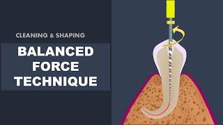 Balanced Force Technique  Cleaning and Shaping