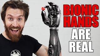 This Bionic Hand Will Change Everything