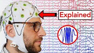 EEG Electroencephalogram Explained