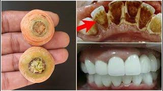 In 2 minutes yellow will make dirty teeth white like pearl and shiny.Home remedy for teeth whitenin