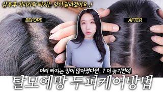 탈모예방 두피케어방법  머리카락 빠지는 양이 많아졌다면? 꼼꼼하게 샴푸방법부터 바꿔보기샴푸방법소개 샴푸추천 헤어케어에 도움된 제품모발운동완료