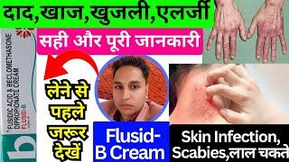 flusid b cream  flusid cream uses in hindi  flusid b cream uses in hindi  flusid-b cream  flusid