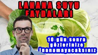 LAHANA SUYUNUN FAYDALARI  Lahana Suyu Zararları ve Kullanımı