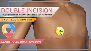 Transgender & Non-binary Double Incision Top Surgery by Dr. Scott Mosser