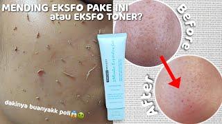 DAKI RONTOK SEMUA REVIEW JUJUR CLEORA 3 MINUTES EXFOLIATING GEL  VIRAL DI TIKTOK