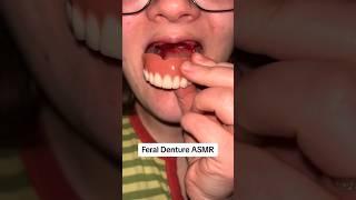 Feral denture asmr #asmr #dentures #toothless #youtubeshorts #subscribe
