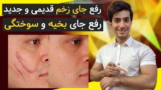 ژل رفع جای زخم قدیمی و جدید  از بین بردن جای بخیه و سوختگی و زخم