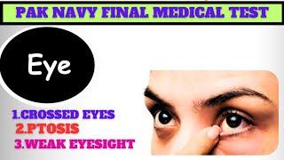 Pak navy Medical TestPak navy Sailors Final Medical Test DetailsUntreated problems in medical test