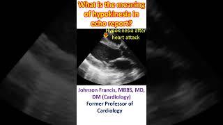 What is the meaning of hypokinesia in echo report?