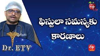 Anal Fistula - Causes  ఫిస్టులా సమస్యకు కారణాలు  Dr.ETV  26th  May 2022  ETV Life