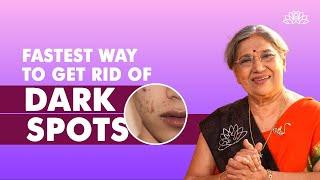 Best Ways To Lighten Your Dark Spots  Dr. Hansaji