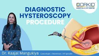 Hysteroscopy Procedure  Pre IVF Treatment Diagnostic Hysteroscopy Surgery in Ankleshwar  Surat